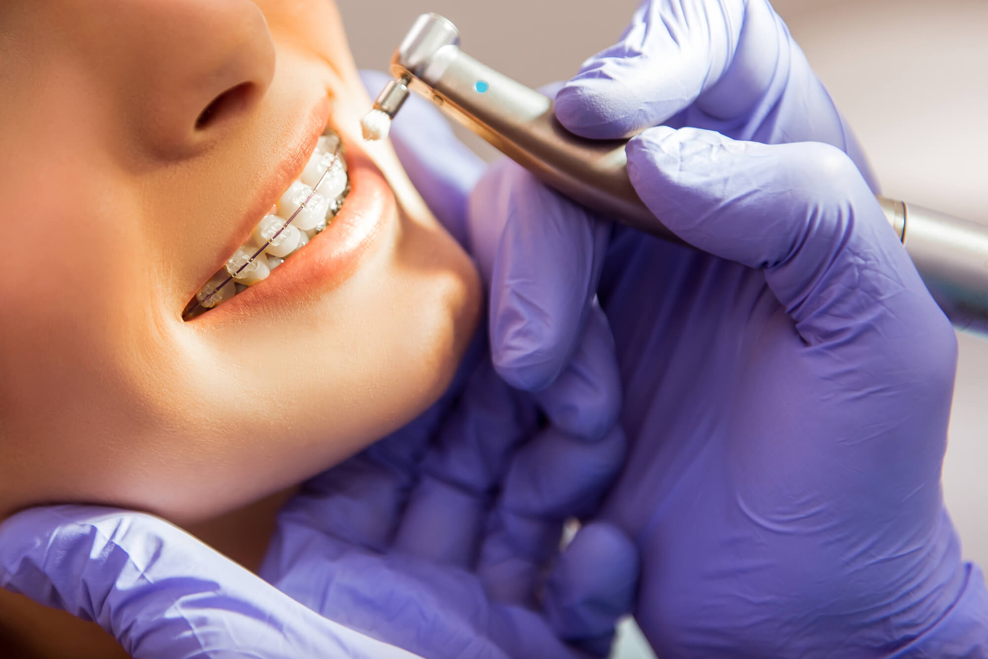 close up dentist and partient during routine appointment for orthodontics in pembroke pines