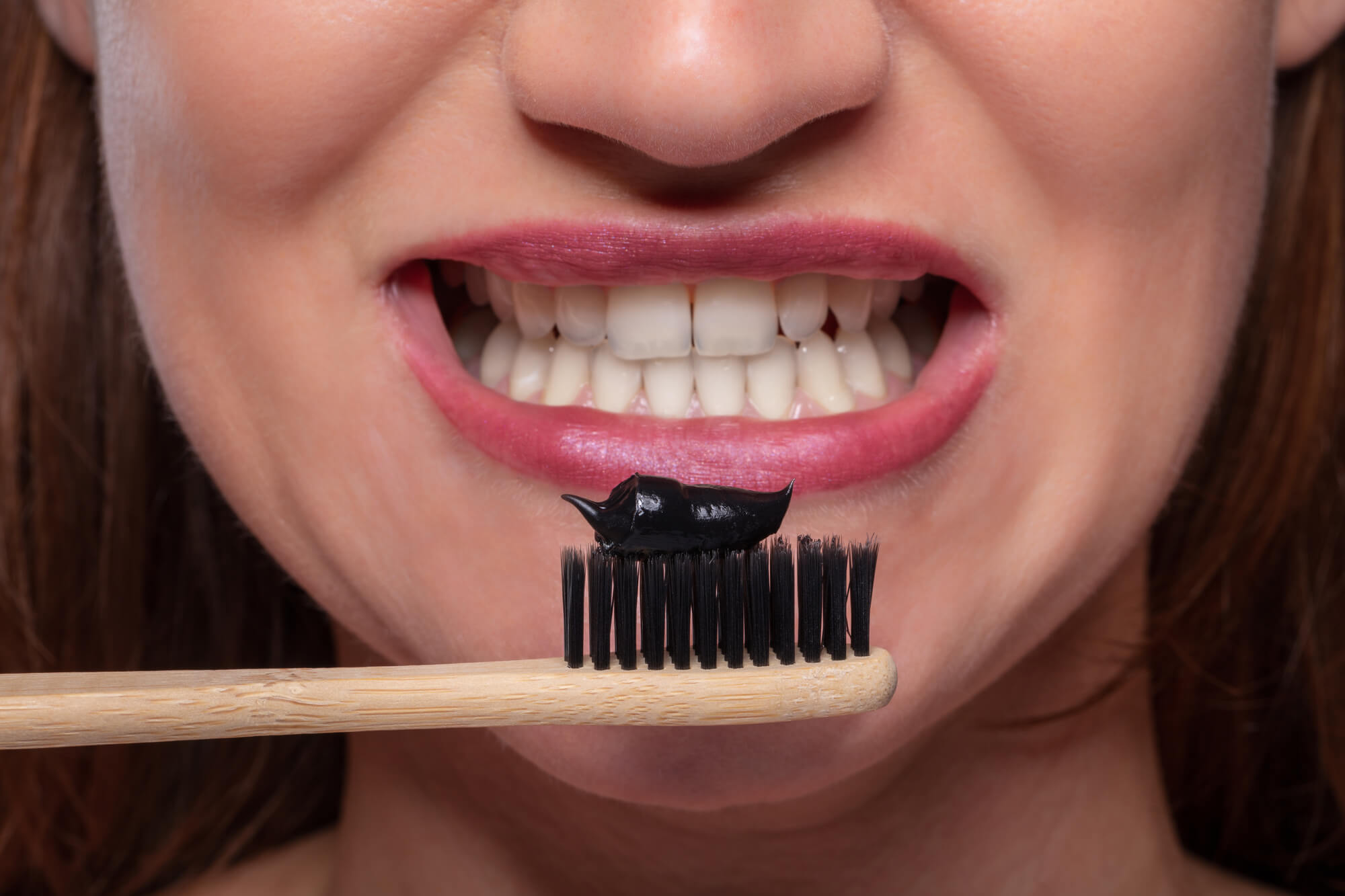 charcoal toothpaste used for miami teeth whitening